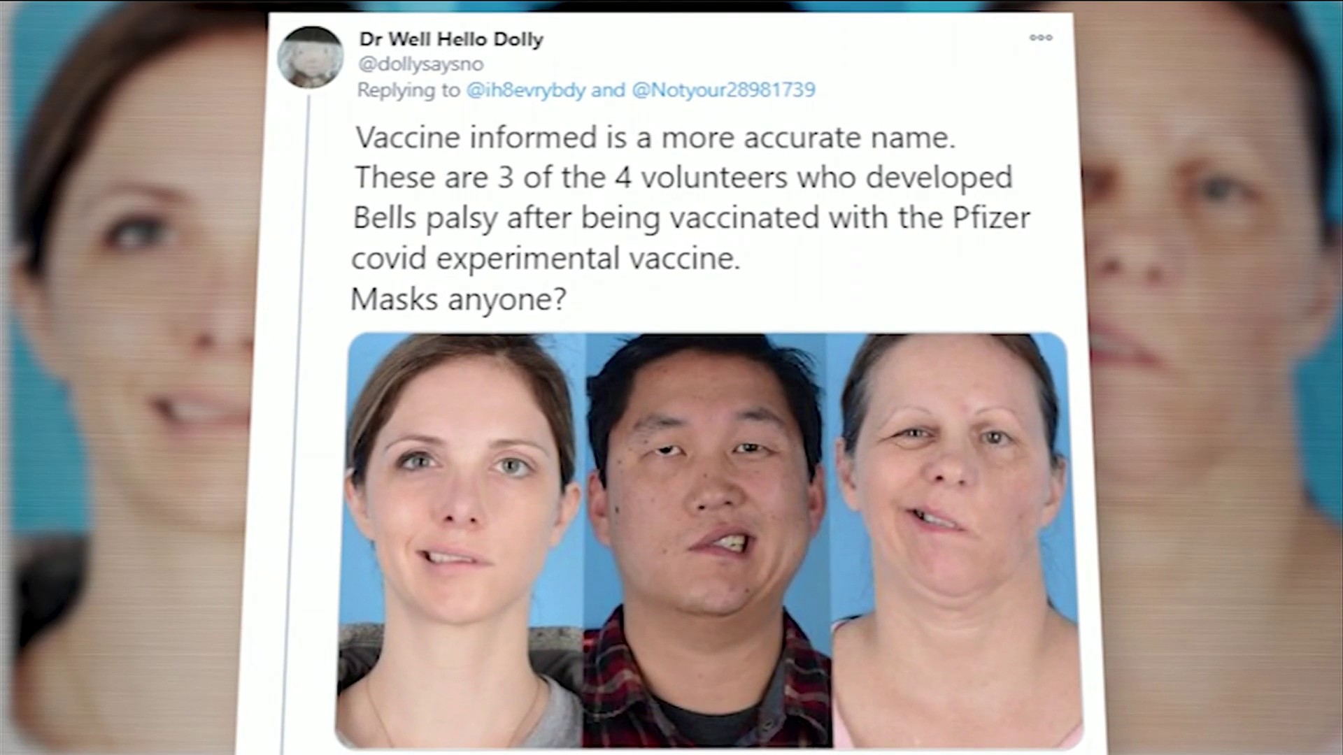 Паралич лица от вакцины